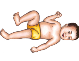 MNRI Asymmetrical Tonic Neck Reflex