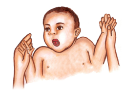 MNRI Babkin Palmomental Reflex
