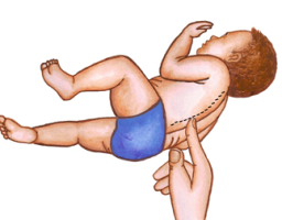 MNRI Spinal Galant Reflex