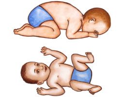 Tonic Labirynthine Reflex